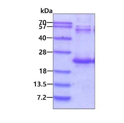 SDS-PAGE: Recombinant Human DR1 His Protein [NBP1-45319]